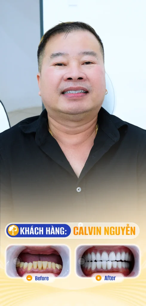 CALVIN NGUYEN
