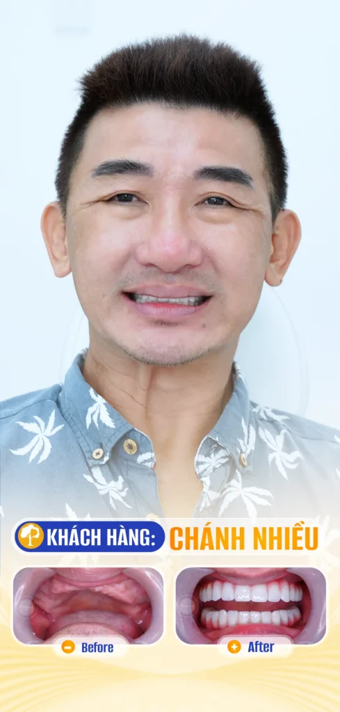 CHÁNH NHIÊU