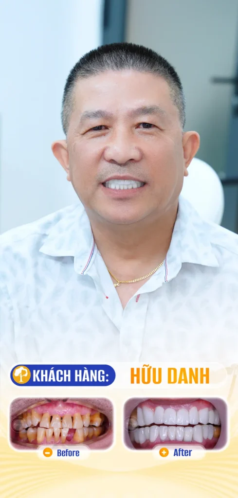 HỮU DANH