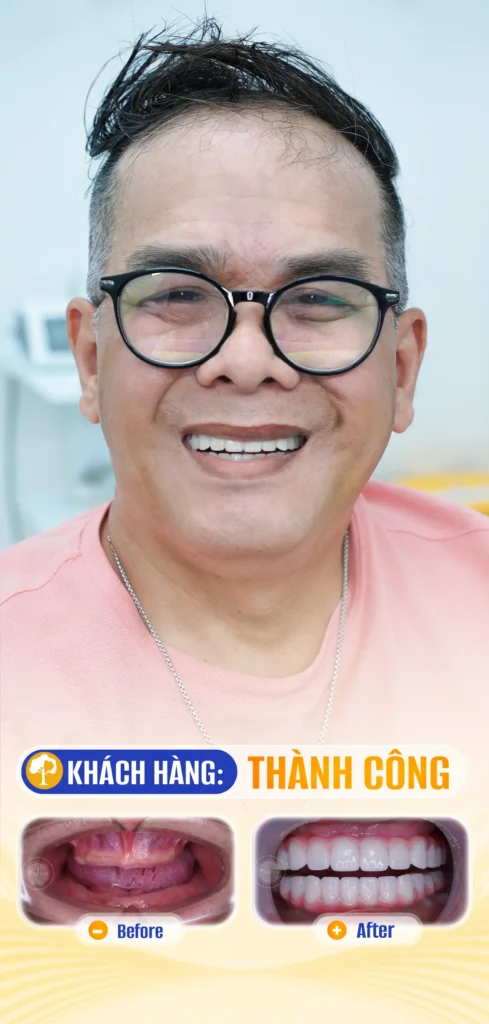 THÀNH CÔNG