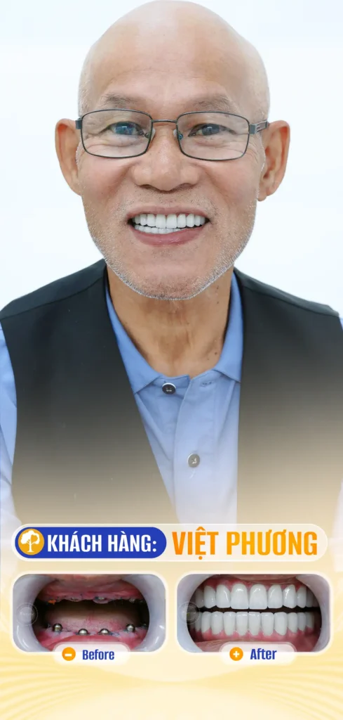 VIỆT PHƯƠNG