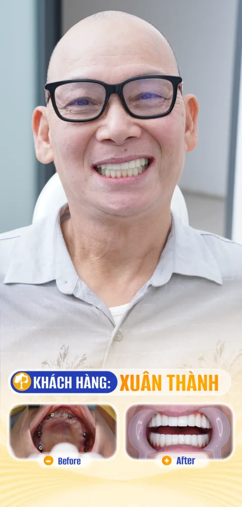 XUÂN THANH